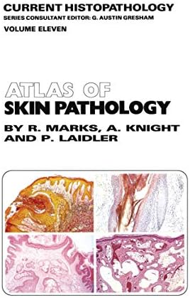 Histopathology of the skin: Walter F. Lever: 9780397520954: Amazon